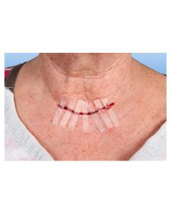 RUDASTRIP® hechtstrips 3x75mm S5